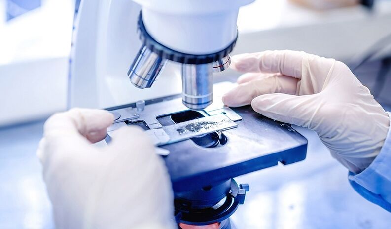 laboratory diagnosis of nail fungus