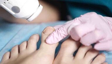 Treatment Mushroom Materials on the legs