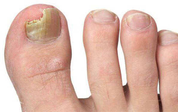 Various forms of fungus