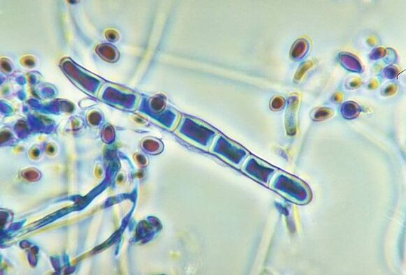 Trichophyton rubrum mushroom under a microscope