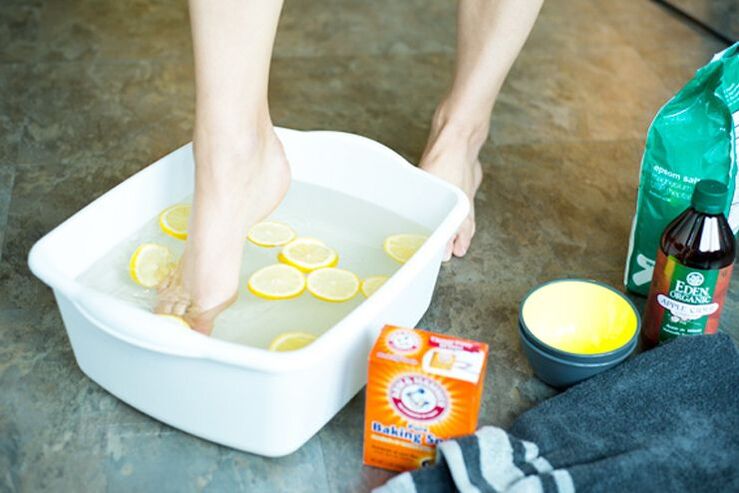 celandine foot bath for nail fungus
