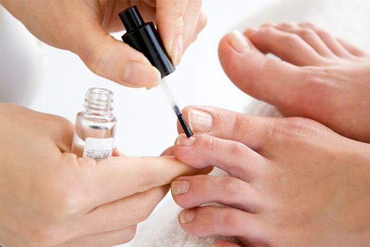 nail fungus varnish